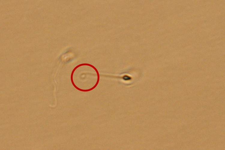 神了！专家们用激光让“小蝌蚪”翘尾巴，完全不动精子症患者夫妇人工受孕