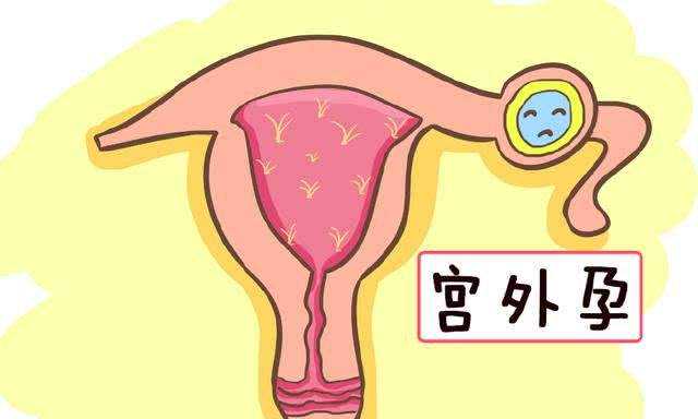 广州怎么等捐卵 2022广州设有精子库的医院有多少家？ ‘怀孕彩超报告看男女’